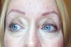 Permanent eyebrows and under eye concealer